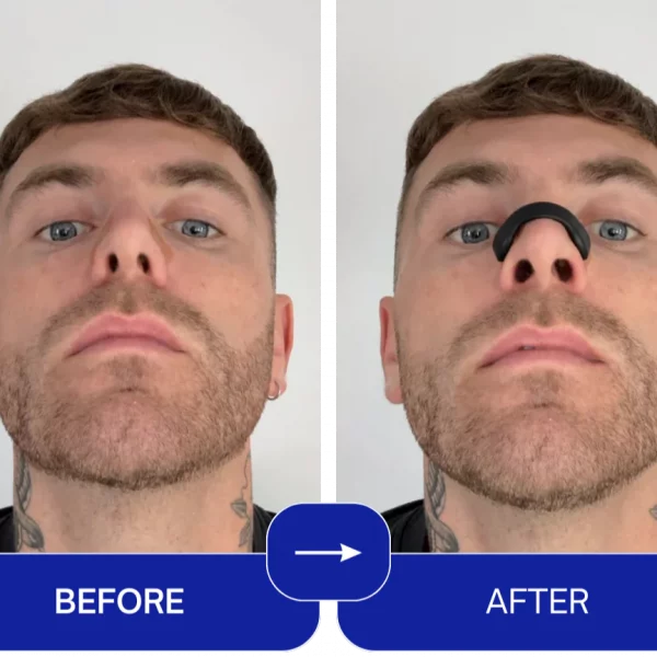 EasyBreathe – Magnetyczne paski na nos (15 szt.) slider